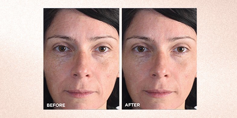 InArticlevitamincretinolhyaluronicacidroutineBAPressed Night Moisturizer With Retinol Niacinamide